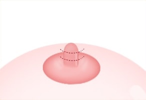 STEP 01