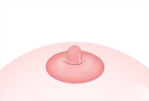 STEP 03