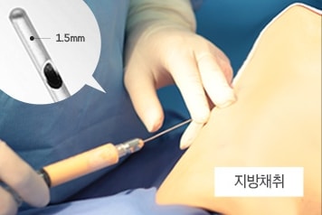 지방채취