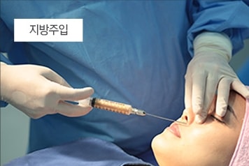줄기세포와 지방주입