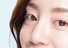 콧등주름