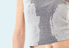 다한증 치료