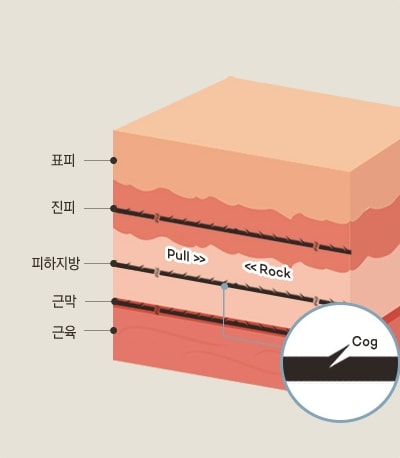 VIP 오메가리프팅