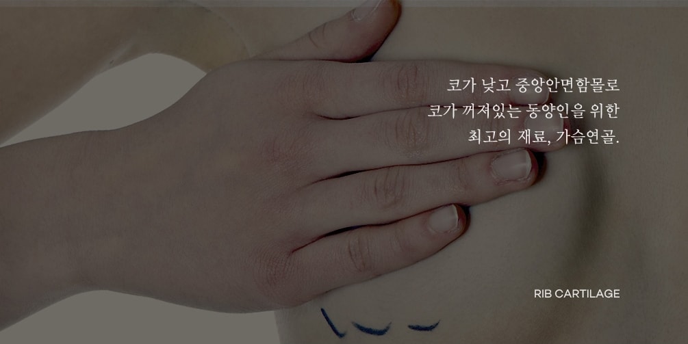 코가 낮고 중앙안면함몰로 코가 꺼져있는 동양인을 위한 최고의 재료, 늑연골(가슴연골). rib cartilage