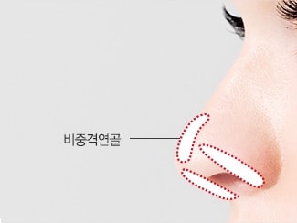 셀럽코성형 수술방법 STEP01